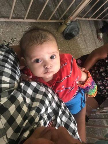 nino post cleft surgery